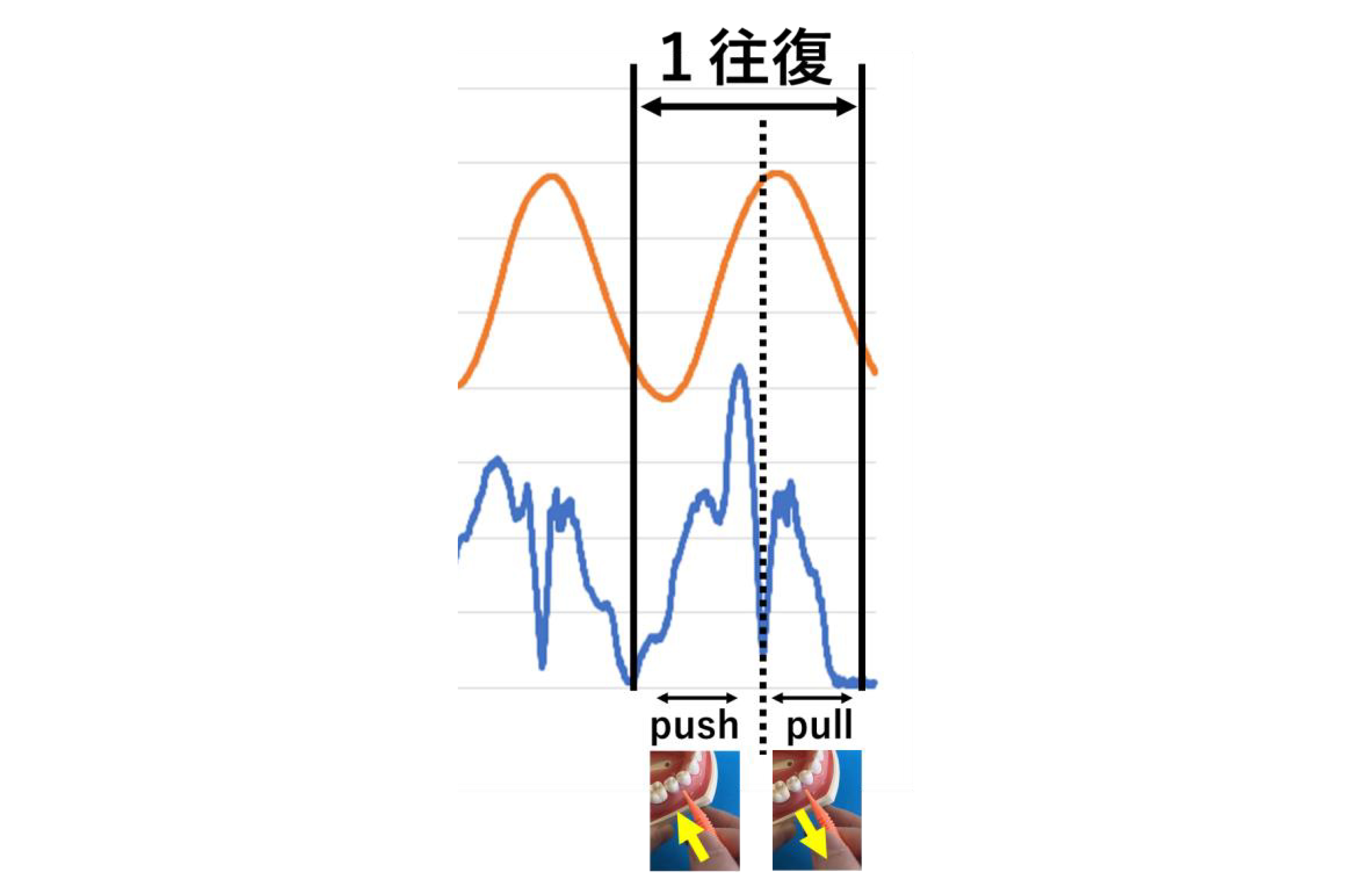 挿入時と引き抜き時の波形